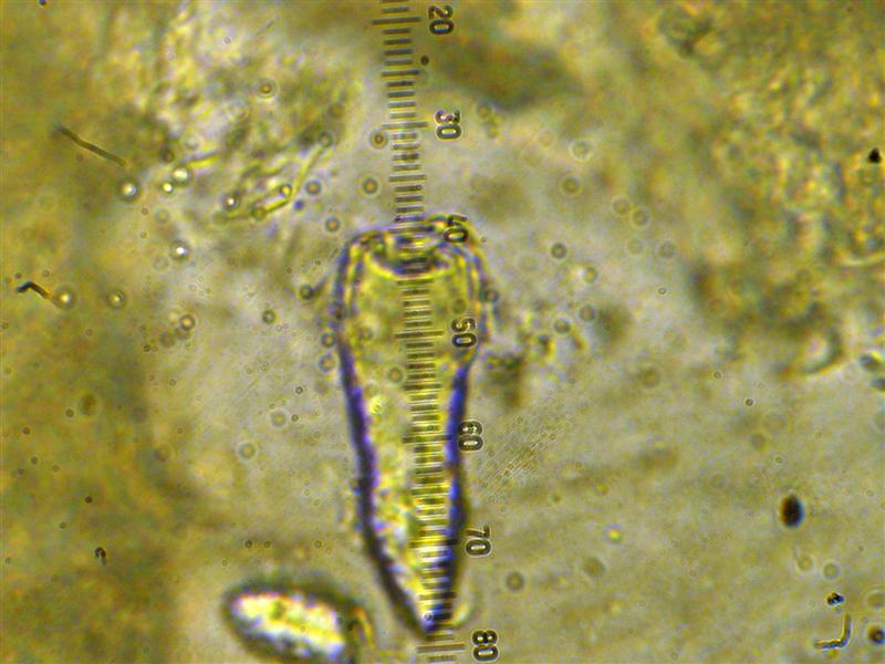 Crosta da determinare (Peniophora incarnata)